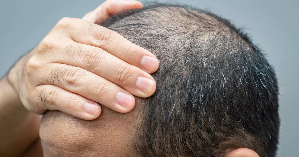 A Common Household Oil That May Reduce Hair Loss Naturally, Expert Says