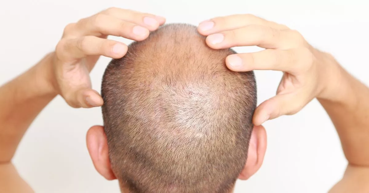 A common household oil could help fight hair loss naturally